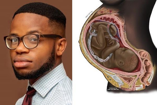 Photograph of Medical Illustrator Chidiebere Ibe. Next to the photograph is a medical illustration by Ibe of a cross-section of a pregnant black woman and black foetus in the womb.